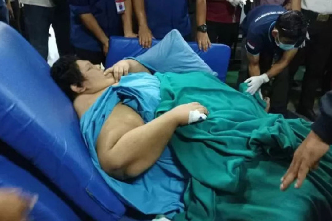 Fajri, pemuda obesitas berbobot 300 kg meninggal dunia(ist)