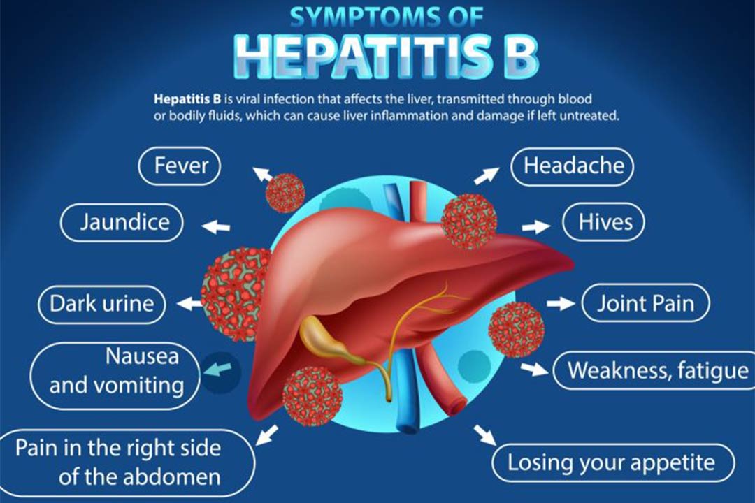 Gejala Penyakit Hepatitis B