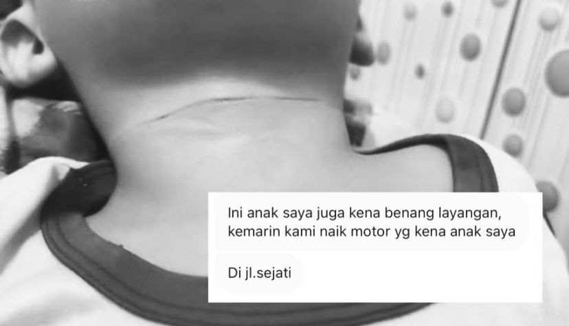 Foto korban yang terkena benang layangan. Foto:(Instagram:kabarsamarinda_official)
